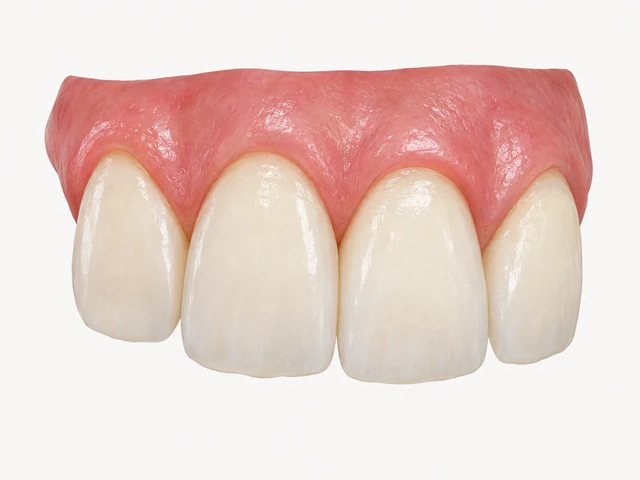 Illustrated front teeth with a subtle variation in neighbouring gum margins.