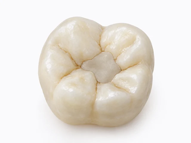 Illustrated chewing surface with a bounded filling flush with the surrounding tooth.