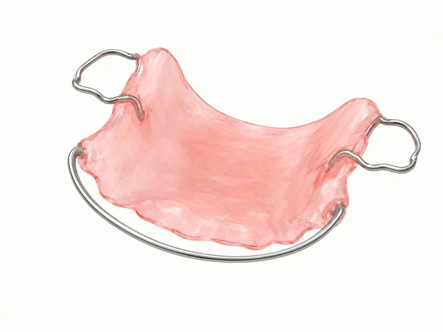 Educational illustration of a removable retainer with a plate and wire components