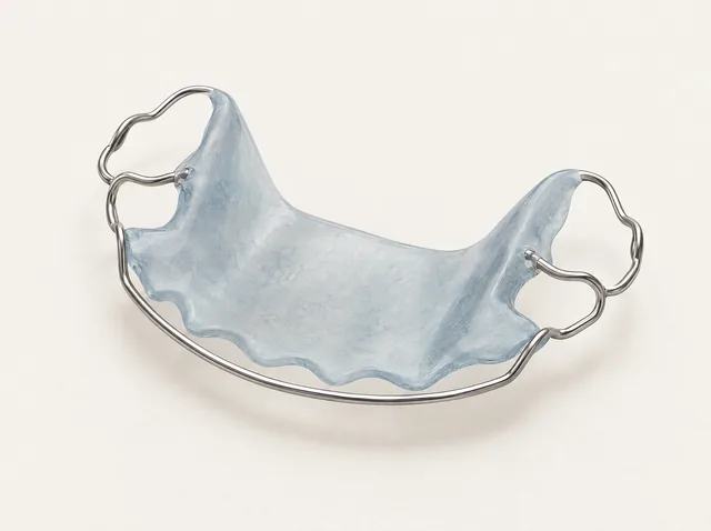 A separate removable-retainer example with a pale blue acrylic plate, front wire and side clasps