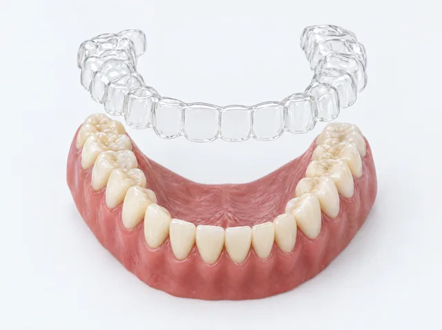 AI educational illustration of an empty transparent aligner lifted above a matching tooth model, with a visible gap between them.