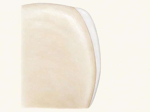 Enlarged schematic section of ceramic added directly outside an unchanged tooth surface.