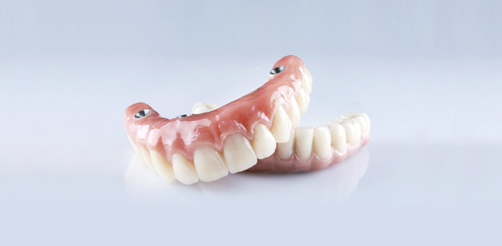 Finished implant-supported denture photographed on a light background
