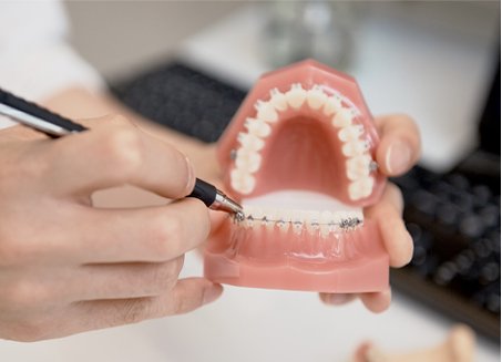 A clinician pointing at a dental model with an instrument during an explanation